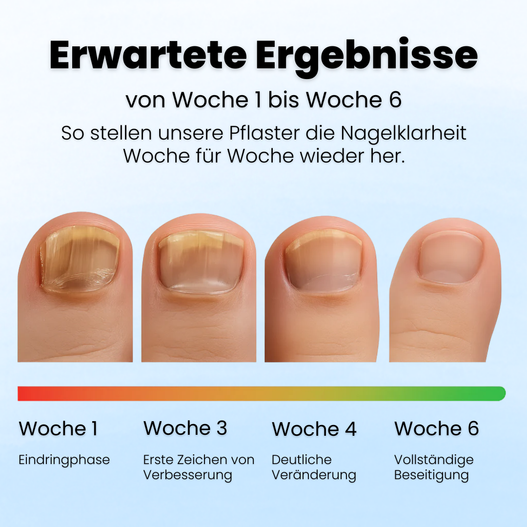 Ruliva™ Nagelpilz Pflaster